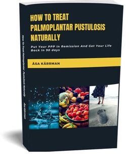  Palmoplantar Pustulosis book page