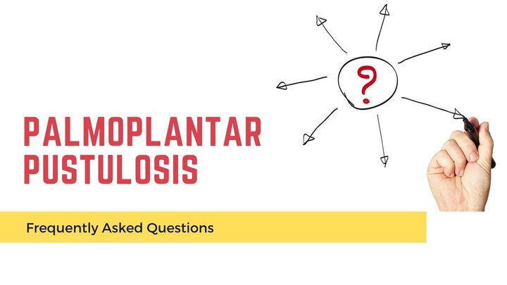 Palmoplantar Pustulosis FAQ