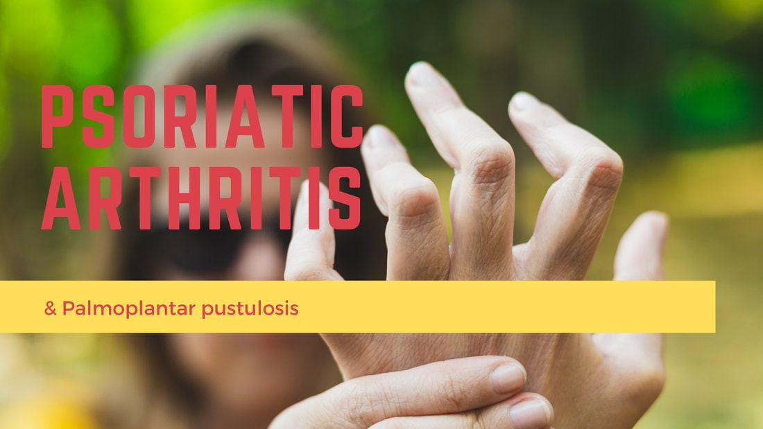 Palmoplantar Pustulosis and Arthritis